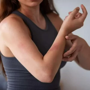 Atención en Colombia por extraña enfermedad de la piel que se convierte en una pesadilla diaria