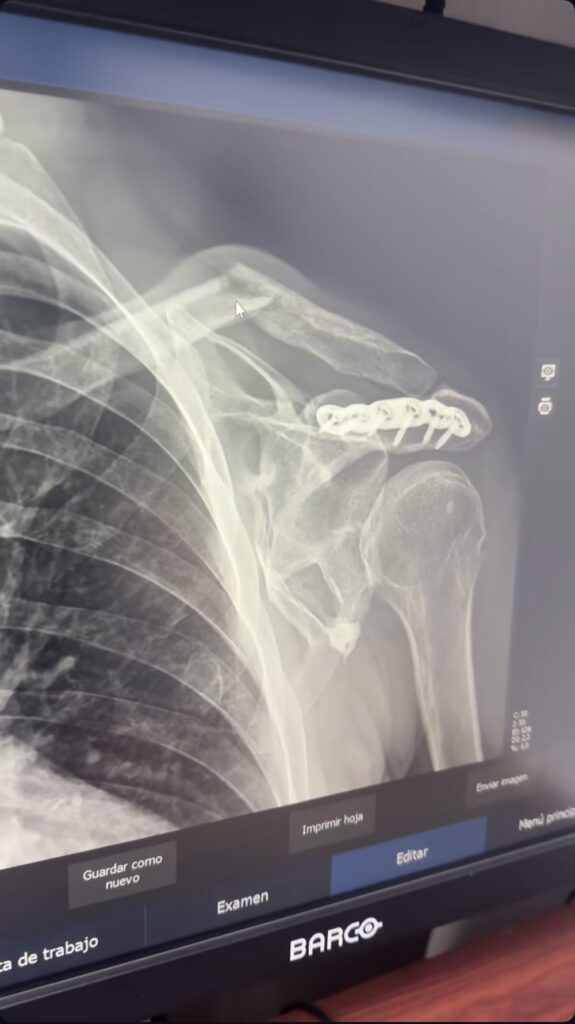 Radiografía Rigoberto Urán