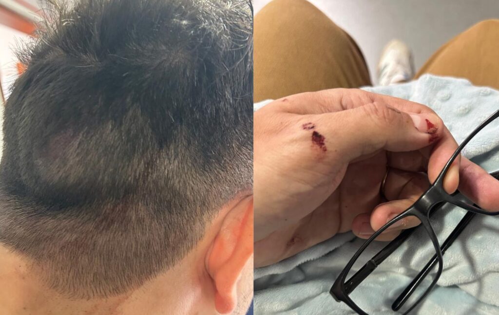 Javier Francisco Benítez, músico de la agrupación del cantante de vallenato, se encuentra en proceso de recuperación tras verse involucrado en un incidente de intolerancia. Foto: Cedidas a Pulzo.